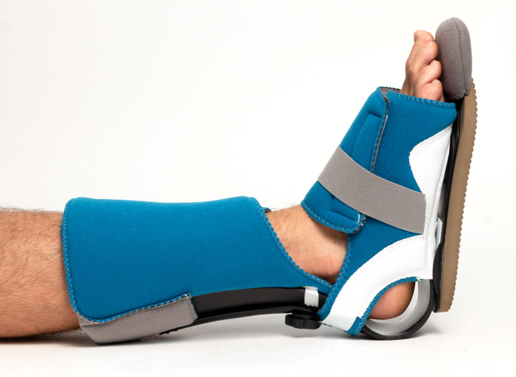 Preventing pressure injuries on the heels is critical for good patient care  - EHOB