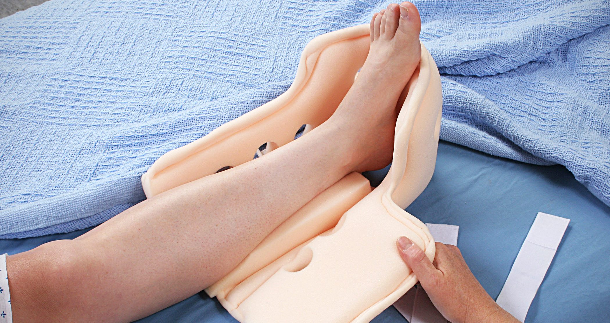 Supine Position Reduces Pressure Ulcers