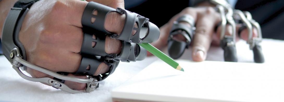 Precision Finger Prosthetics